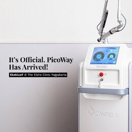 The Elshe Clinic Membawa Teknologi Laser Tercanggih ke Jogja!